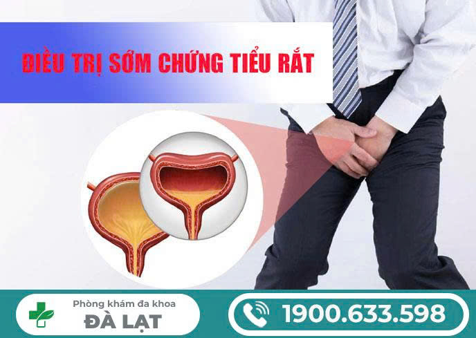 Hình ảnh minh họa